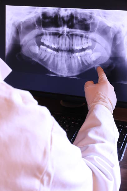 Best Emergency Dentist for Knocked-Out Tooth in Maywood, IL
