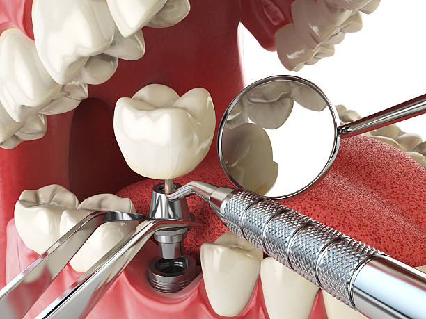 Best Mobile Emergency Dentist in Maywood, IL